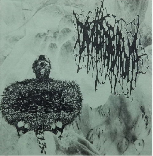 Urinary Tract Infection From Severe Pus Clots : Urinary Tract Infection From Severe Pus Clots - Dermatofibrosarcoma